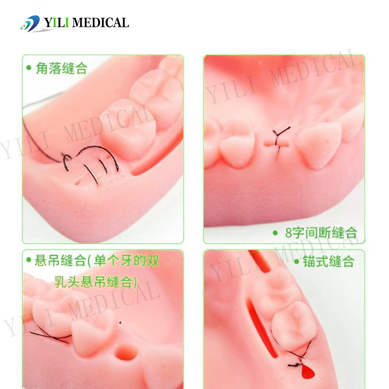 Gingival wound suture pad (7).jpg