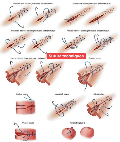 suture pad (2).jpg